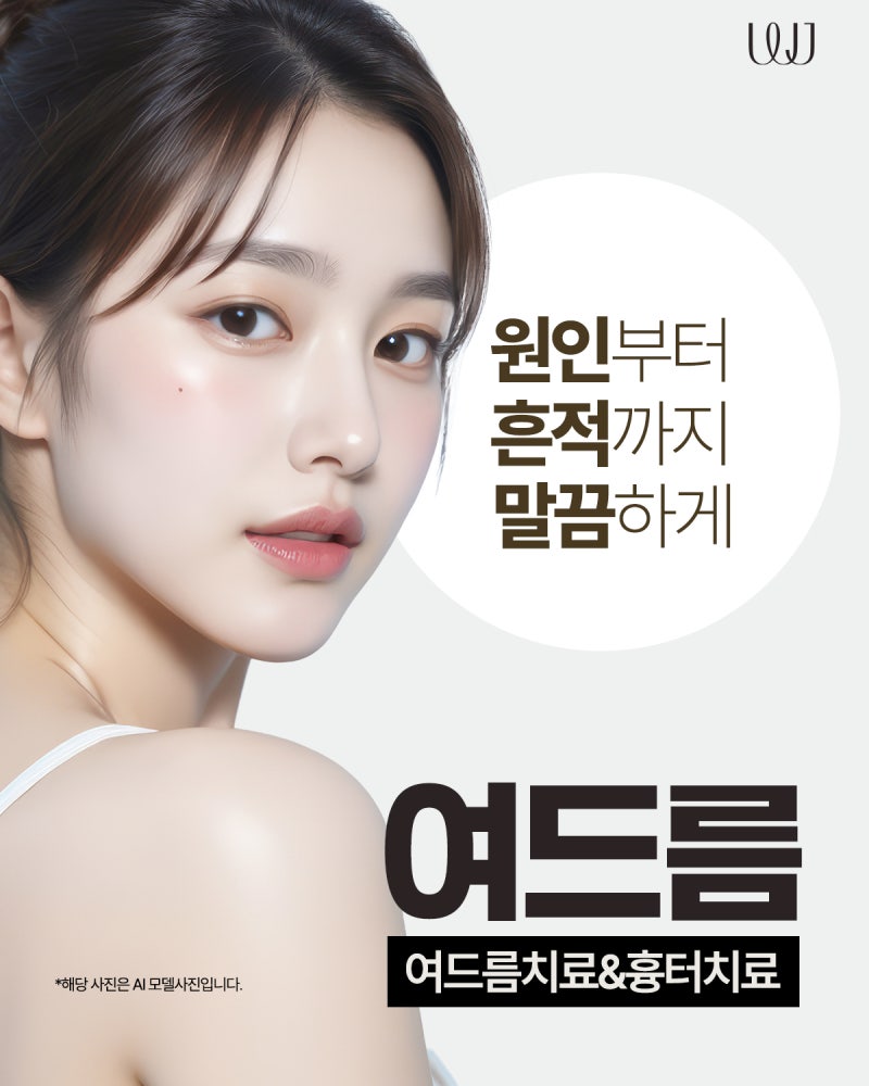 재발하는 여드름 원인과 피부과 레이저 치료방법