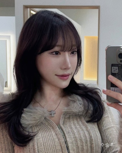 돌출된 광대 윤곽3종 전후와 회복기간 사진 11