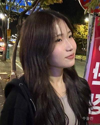 不对称大小眼修复与下垂鼻整形前后对比 사진 10