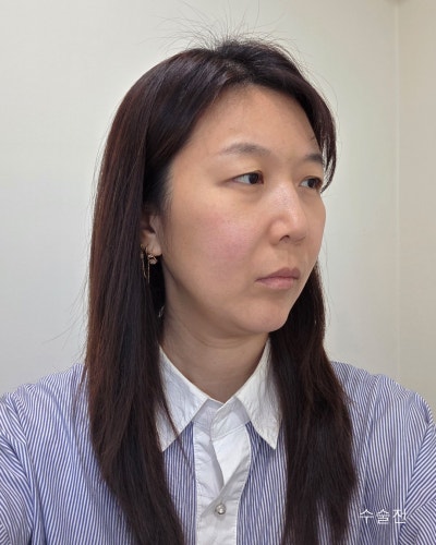 이마거상, 눈매교정, 눈밑지, 엘꿈리프팅 전후 사진 8