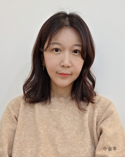 이마거상, 눈매교정, 눈밑지, 엘꿈리프팅 전후 사진 11