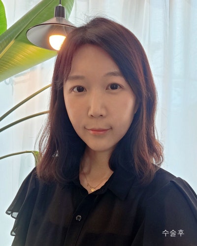 이마거상, 눈매교정, 눈밑지, 엘꿈리프팅 전후 사진 3